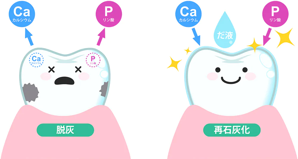 フッ素塗布