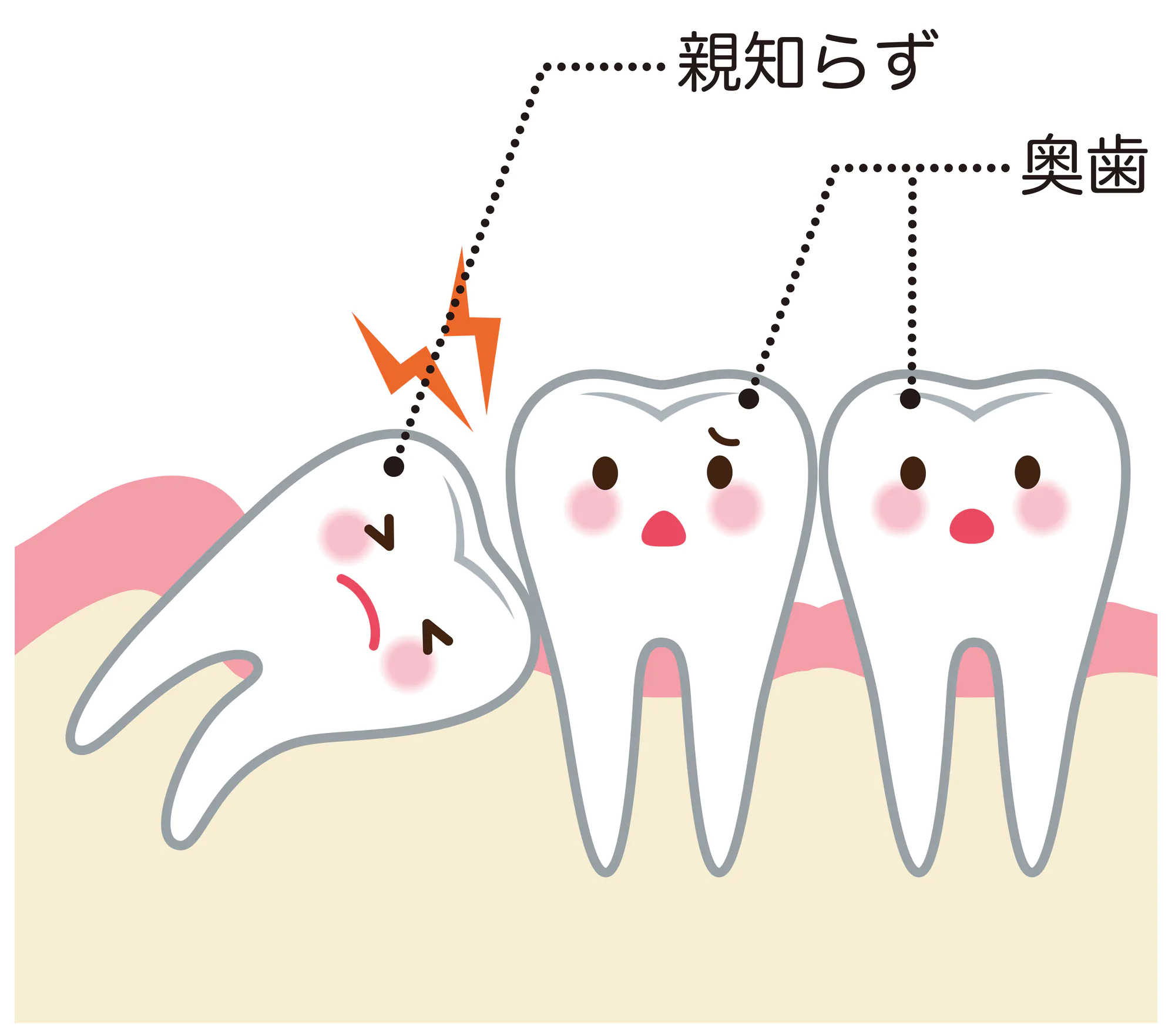 当院の安全な親知らずの抜歯